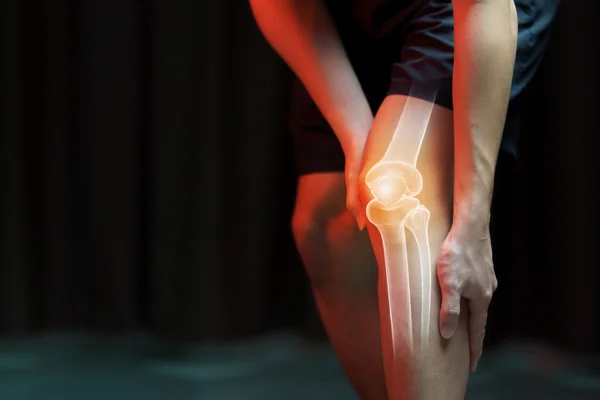 Knee Replacement
