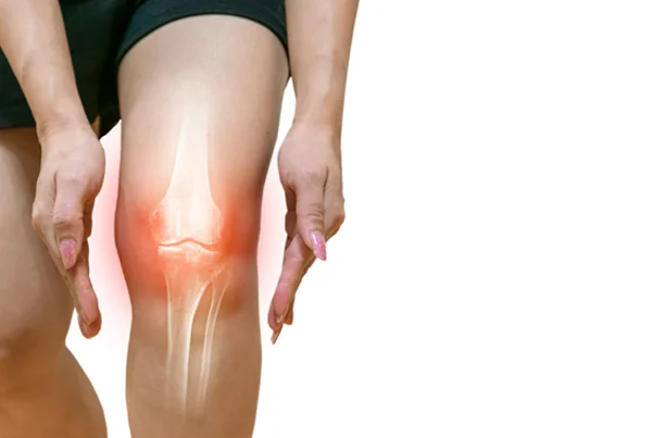 Arthroscopy