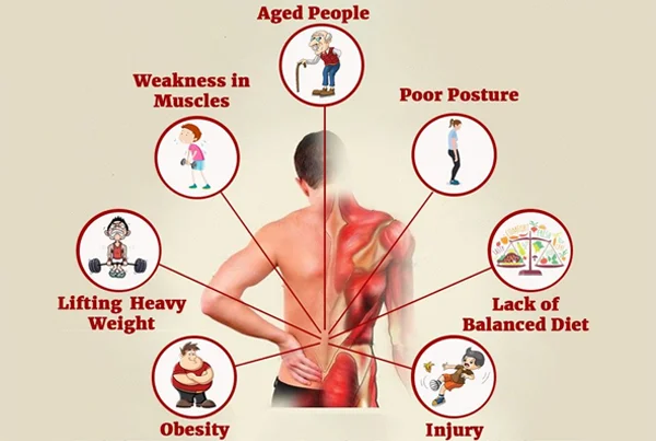 Low Back Pain
